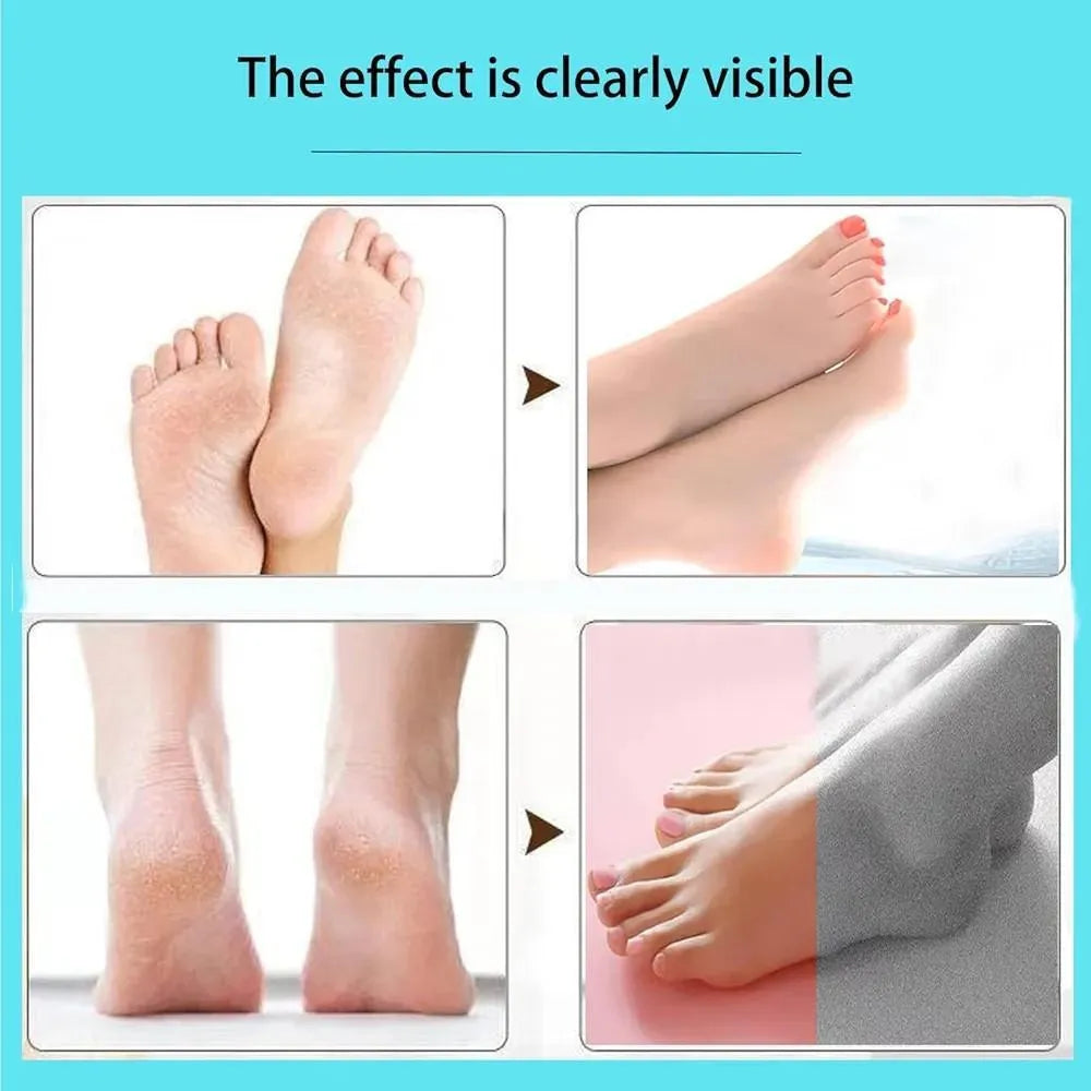 Electric Foot Exfoliating Scrubber